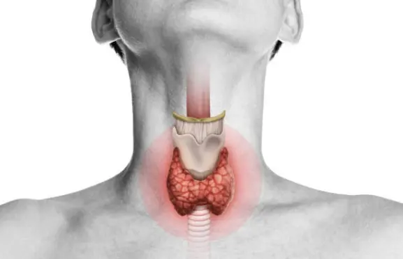 Thyroid Conditions Treatment Chiropractor in Stuart, FL Near Me